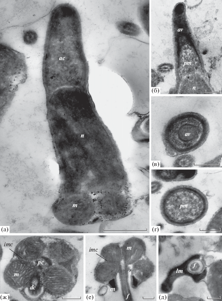 Сперматозоид - Spermatozoon